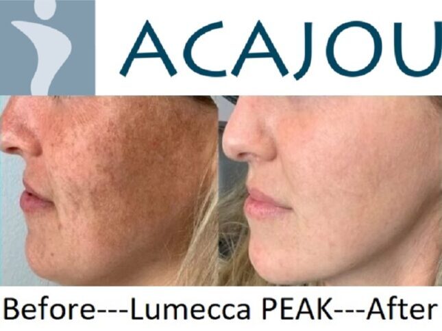 Acajou Front Page e1771562800581