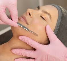 Dermaplaning